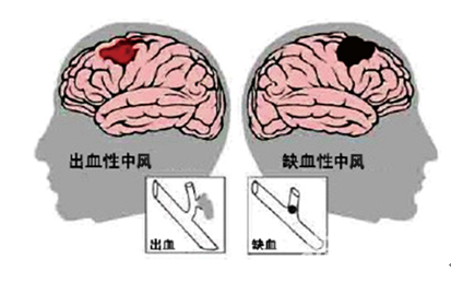 &#21326;&#20307;&#20250;&#20307;&#32946;&#45;&#21326;&#20307;&#20250;&#40;&#20013;&#22269;&#41;